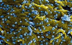 Virus Marburg (màu xanh lam), vừa sinh sôi và gắn trên bề mặt của các tế bào bị nhiễm bệnh (màu vàng). Ảnh: Internet